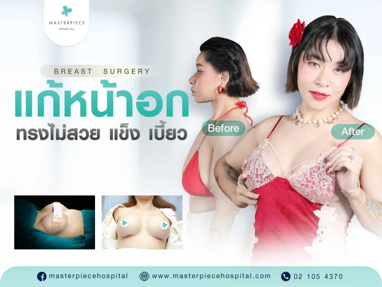 แก้หน้าอกทรงไม่สวย หน้าอกแข็ง หน้าอกเบี้ยว