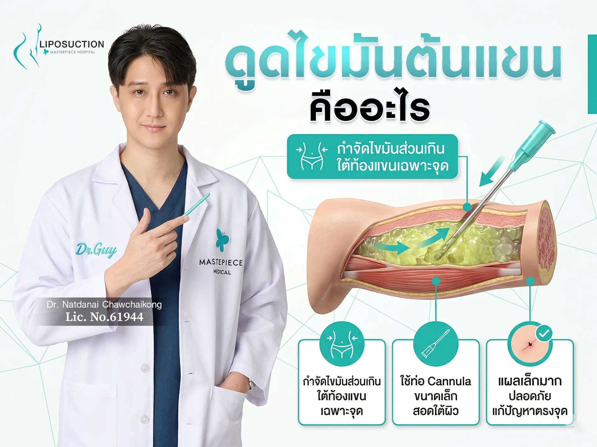 ดูดไขมันต้นแขนคืออะไร