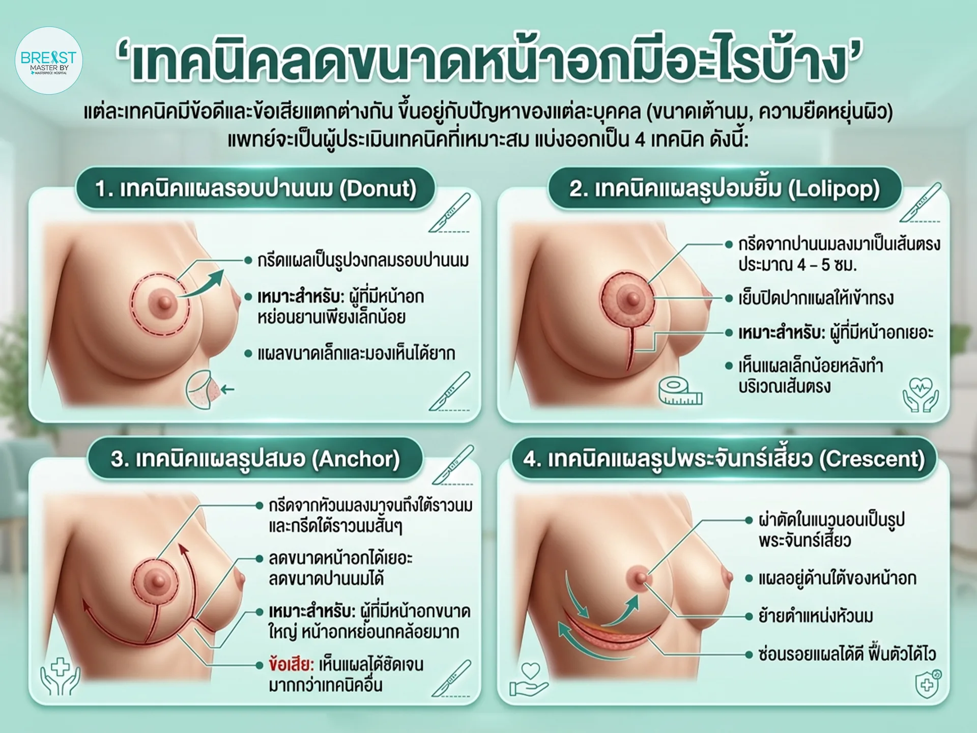 เทคนิคลดขนาดหน้าอกมีอะไรบ้าง