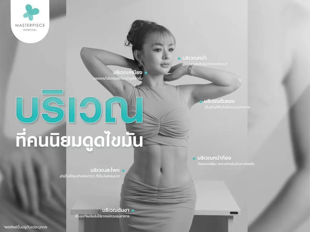 ตำแหน่งยอดนิยมการดูดไขมัน