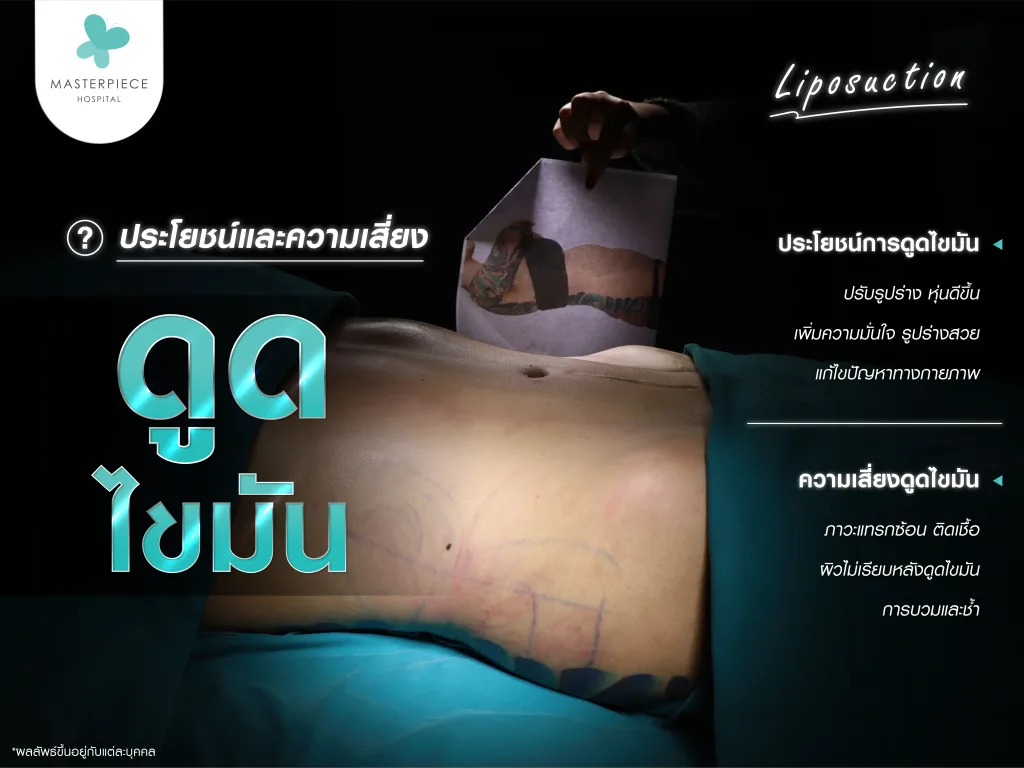 ประโยชน์และความเสี่ยงของการดูดไขมัน