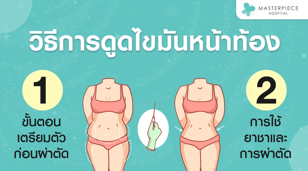 วิธีการดูดไขมันหน้าท้อง วิธีการดูดไขมันหน้าท้อง