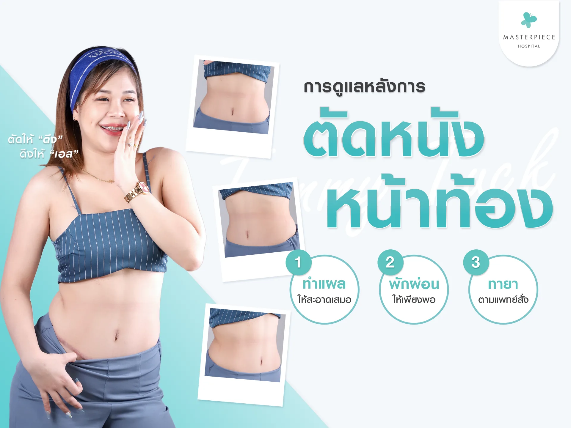 การดูแลหลังการ ตัดหนังหน้าท้อง