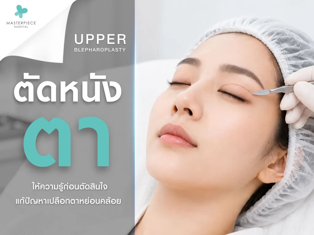 ตัดหนังตา (Upper Blepharoplasty)