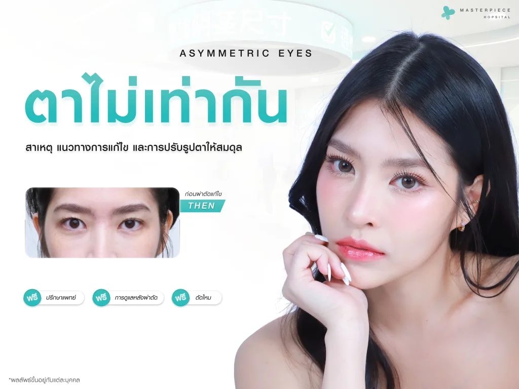 ตาไม่เท่ากัน (Asymmetric Eyes) สาเหตุ แนวทางแก้ไข และการปรับรูปตาให้สมดุล