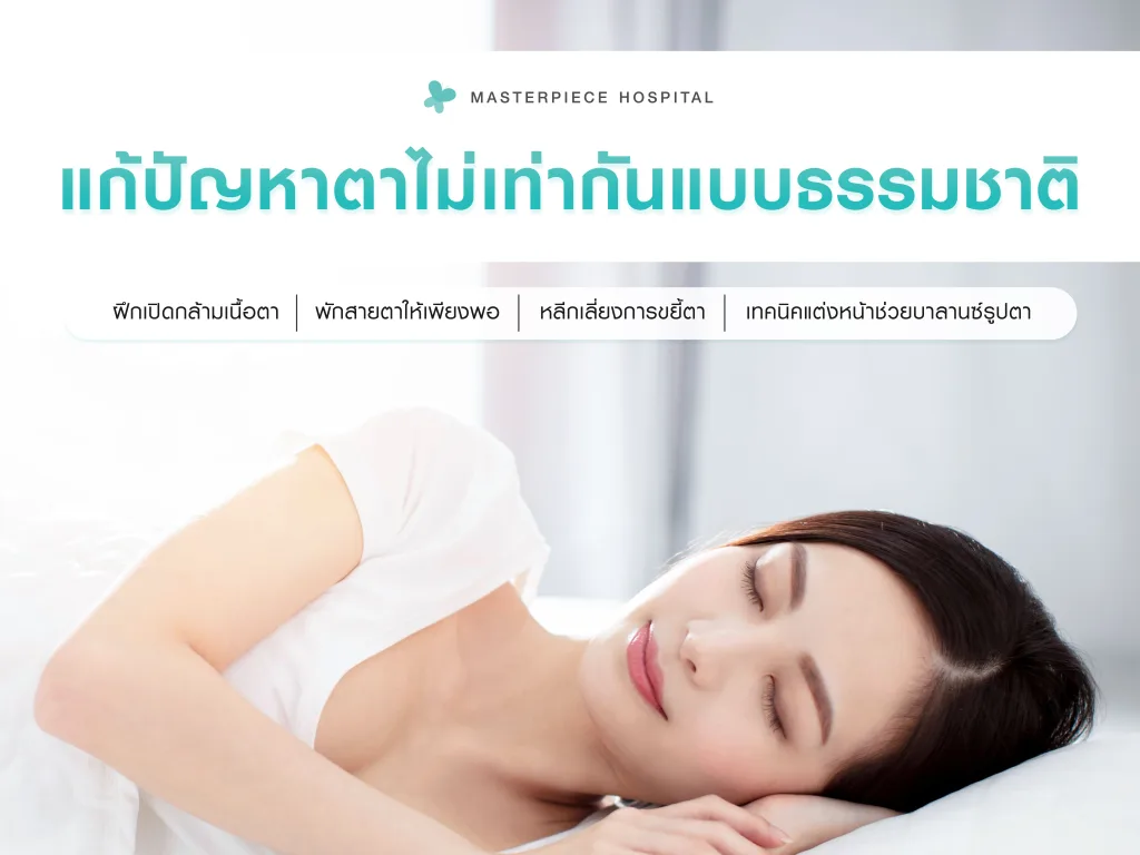 วิธีแก้ปัญหาตาไม่เท่ากันแบบธรรมชาติ