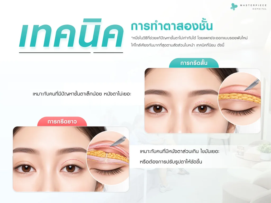 เทคนิคการทำตาสองชั้นเพื่อปรับรอยพับให้สมดุล