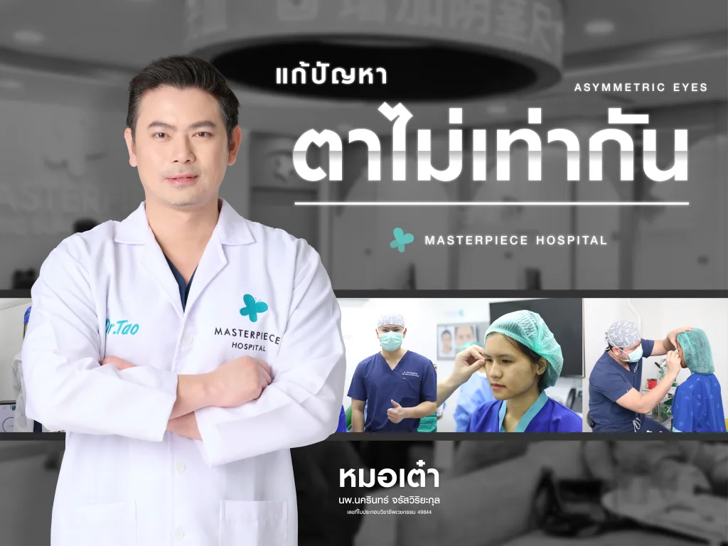 แก้ตาไม่เท่ากันที่มาสเตอร์พีช