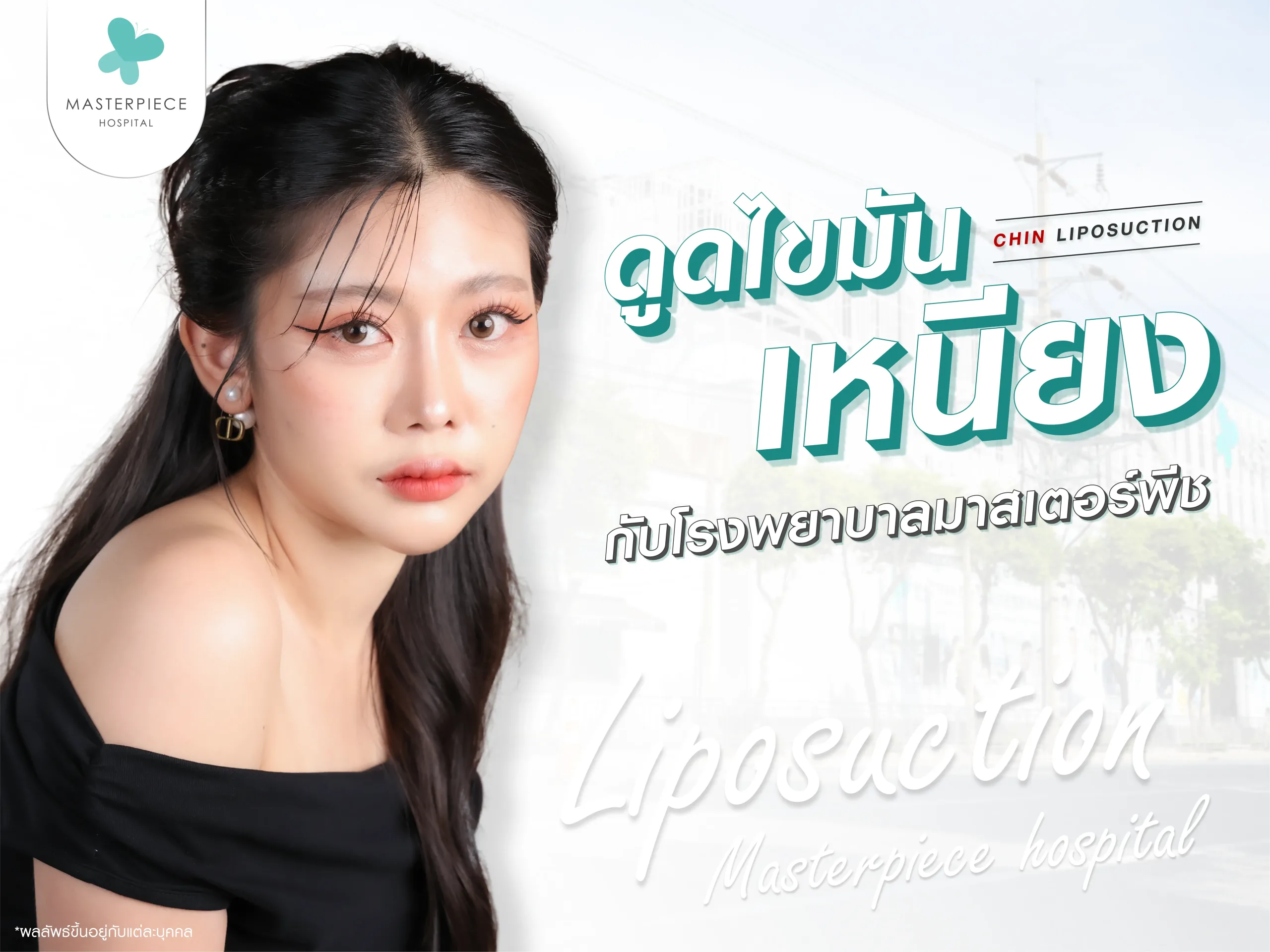 บริการดูดไขมันเหนียง ที่โรงพยาบาลมาสเตอร์พีช
