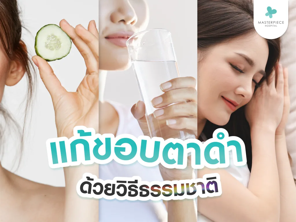 วิธีแก้ขอบตาดำ ด้วยวิธีธรรมชาติ