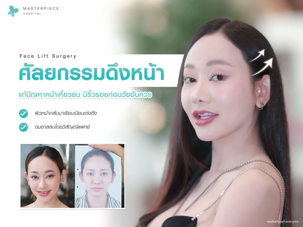 ดึงหน้า ศัลยกรรมย้อนวัย