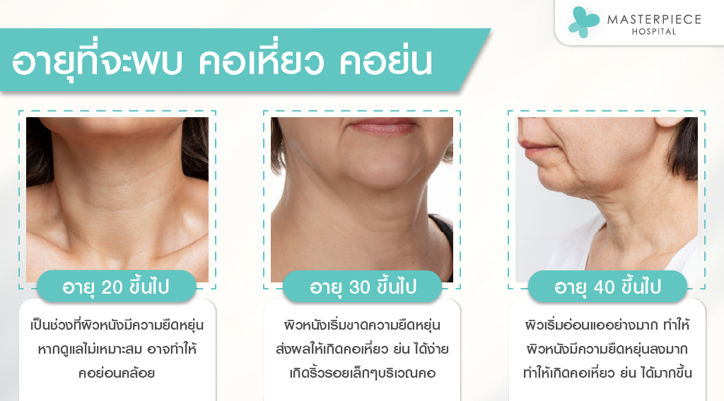 อายุที่จะพบคอเหี่ยวคอย่น อายุ 20 อายุ 30 40 ขึ้นไป