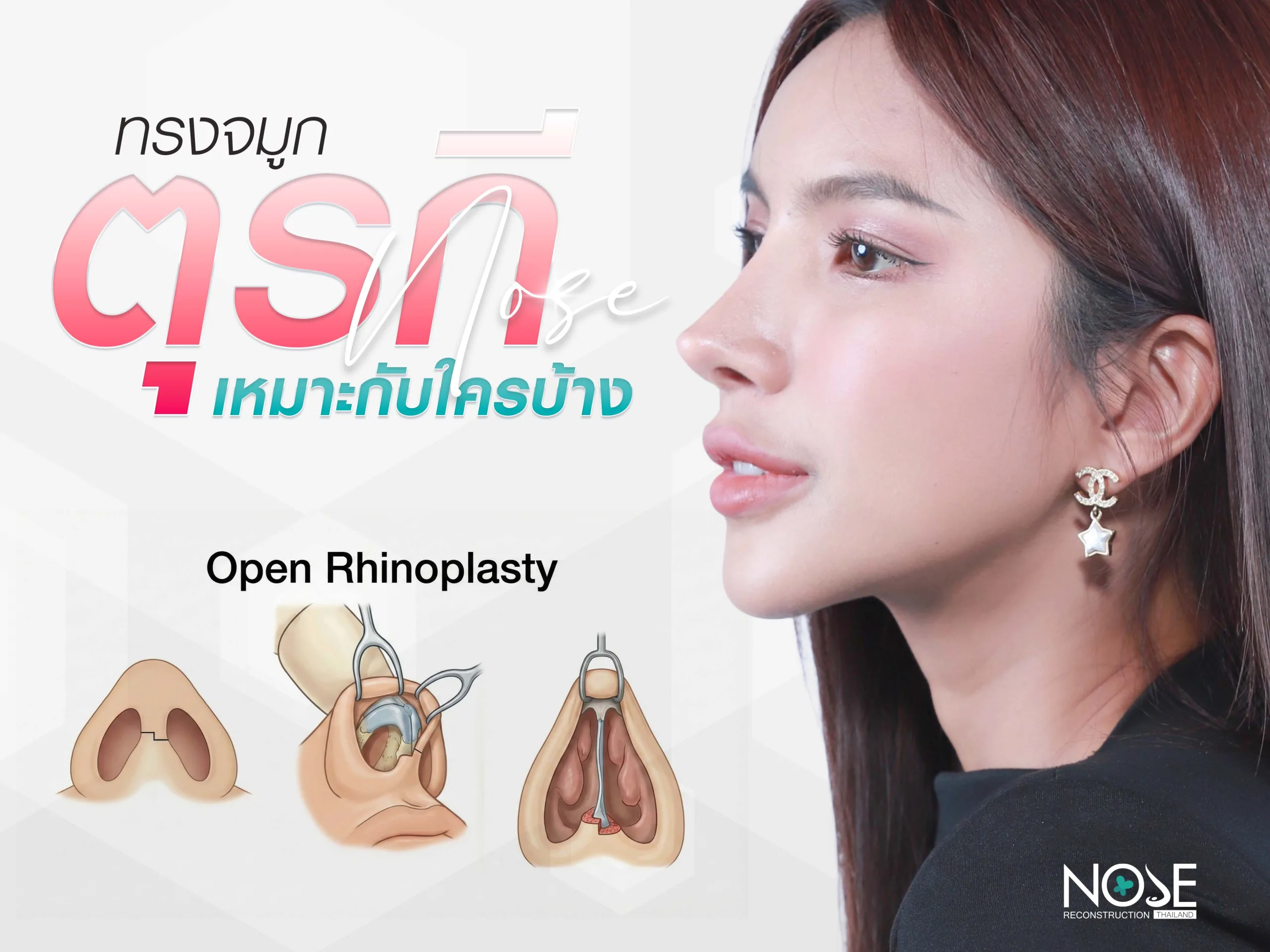 เทคนิคที่ใช้ในการทำจมูกตุรกี