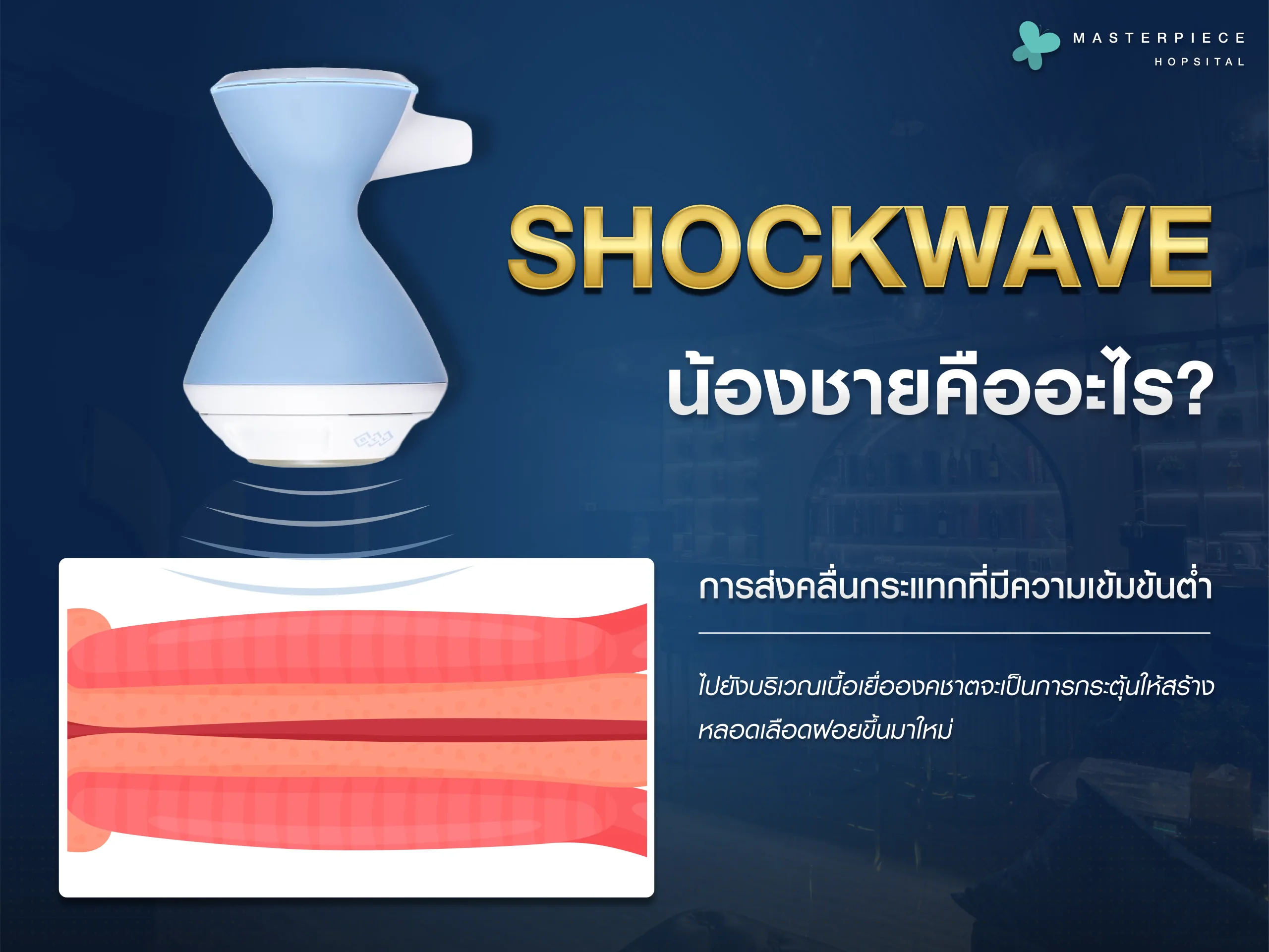 shockwave น้องชายคืออะไร