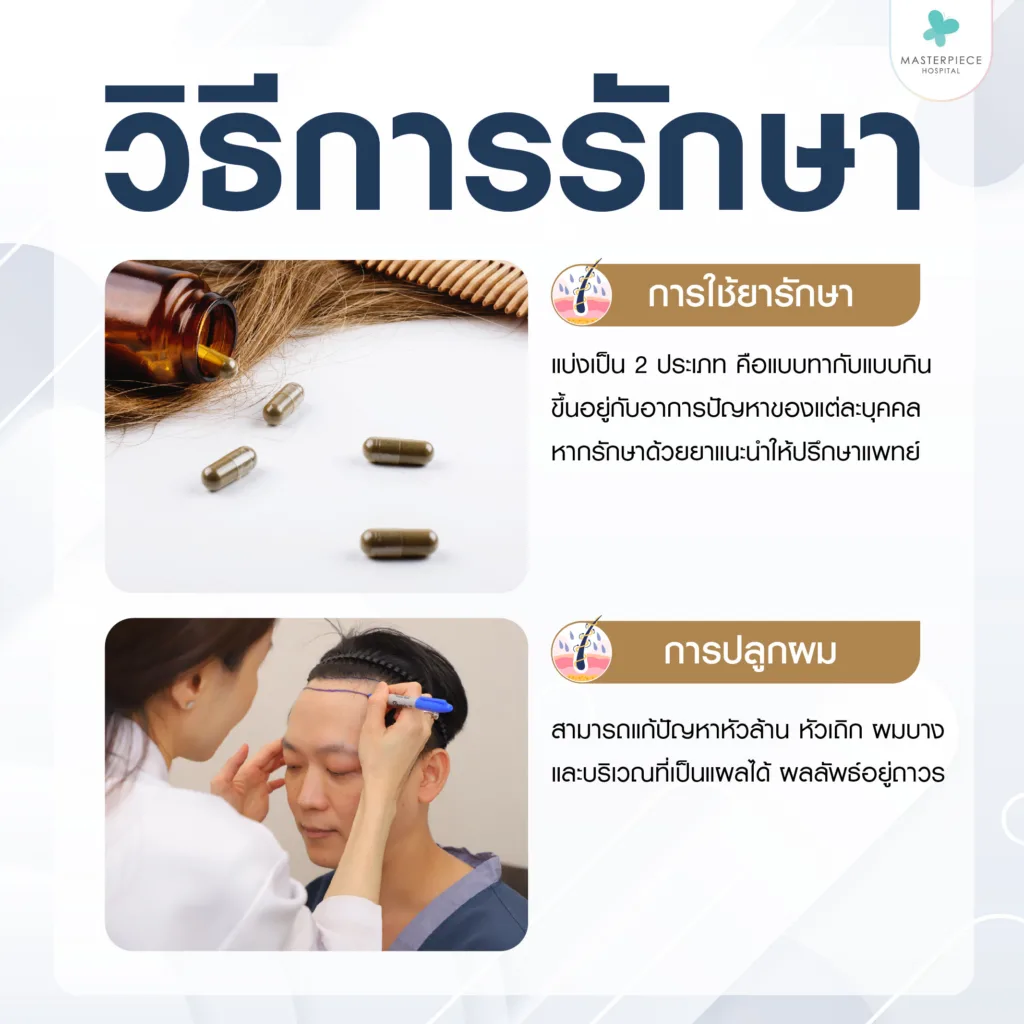 วิธีการรักษาผมร่วง วิธีการรักษาผมร่วง