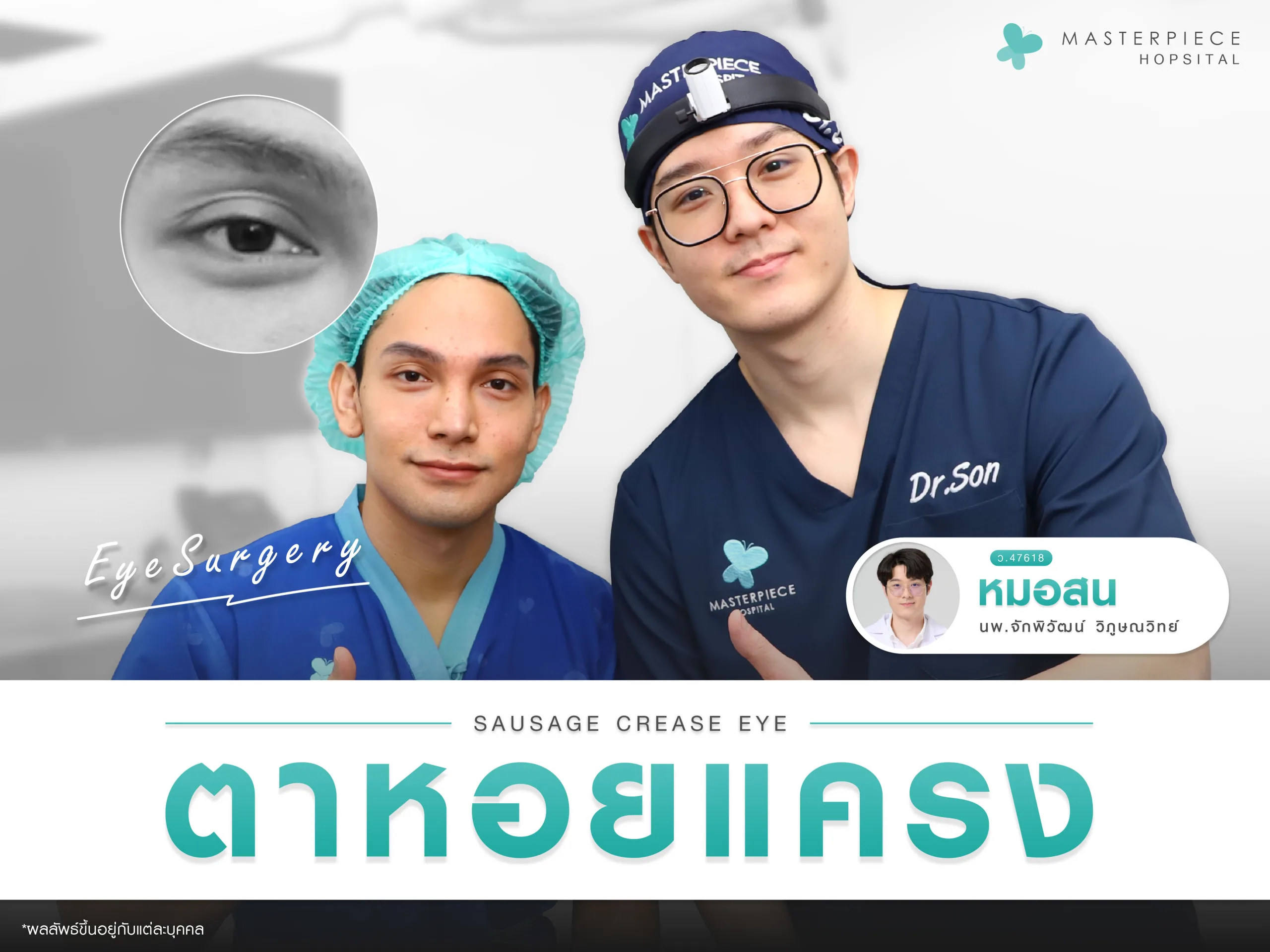 ตาหอยแครงคืออะไร แก้ได้ ป้องกันได้ เชื่อหมอ