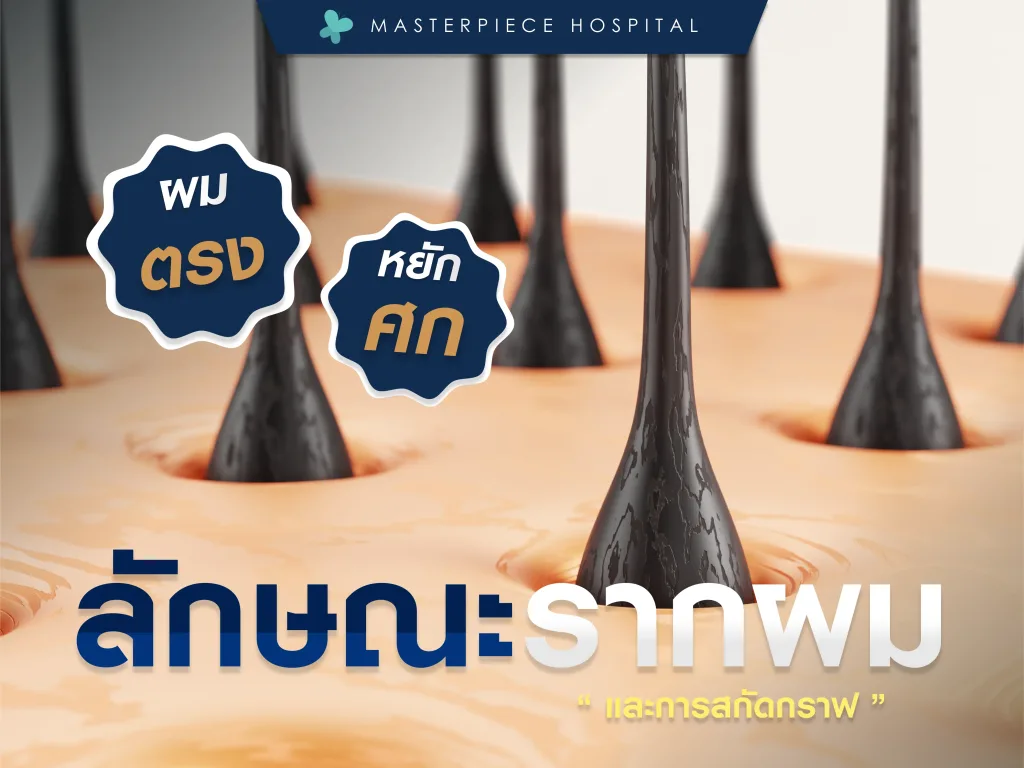 ลักษณะของรากผมและการสกัดกราฟ