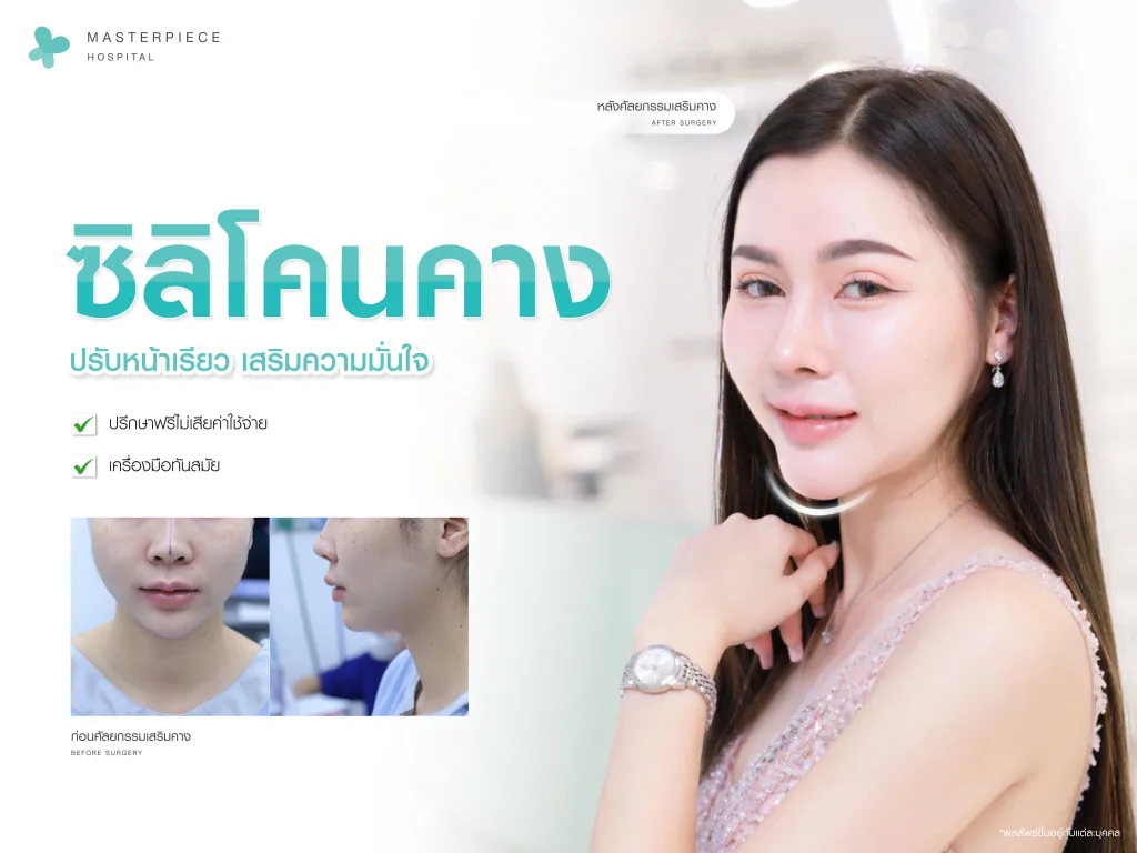 ซิลิโคนคาง ปรับหน้าเรียว
