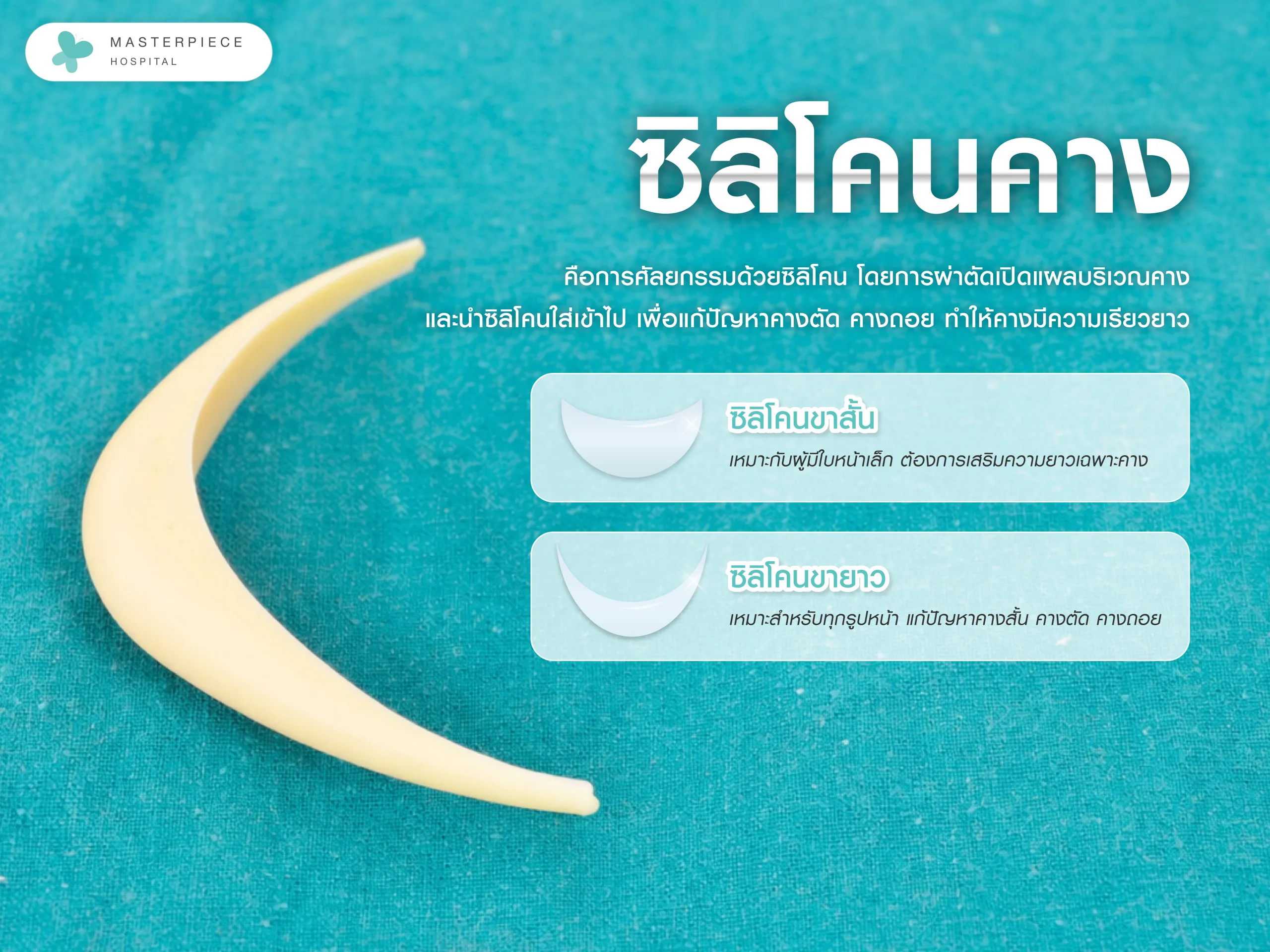 ซิลิโคนคาง คืออะไร มีกี่รูปแบบ ?