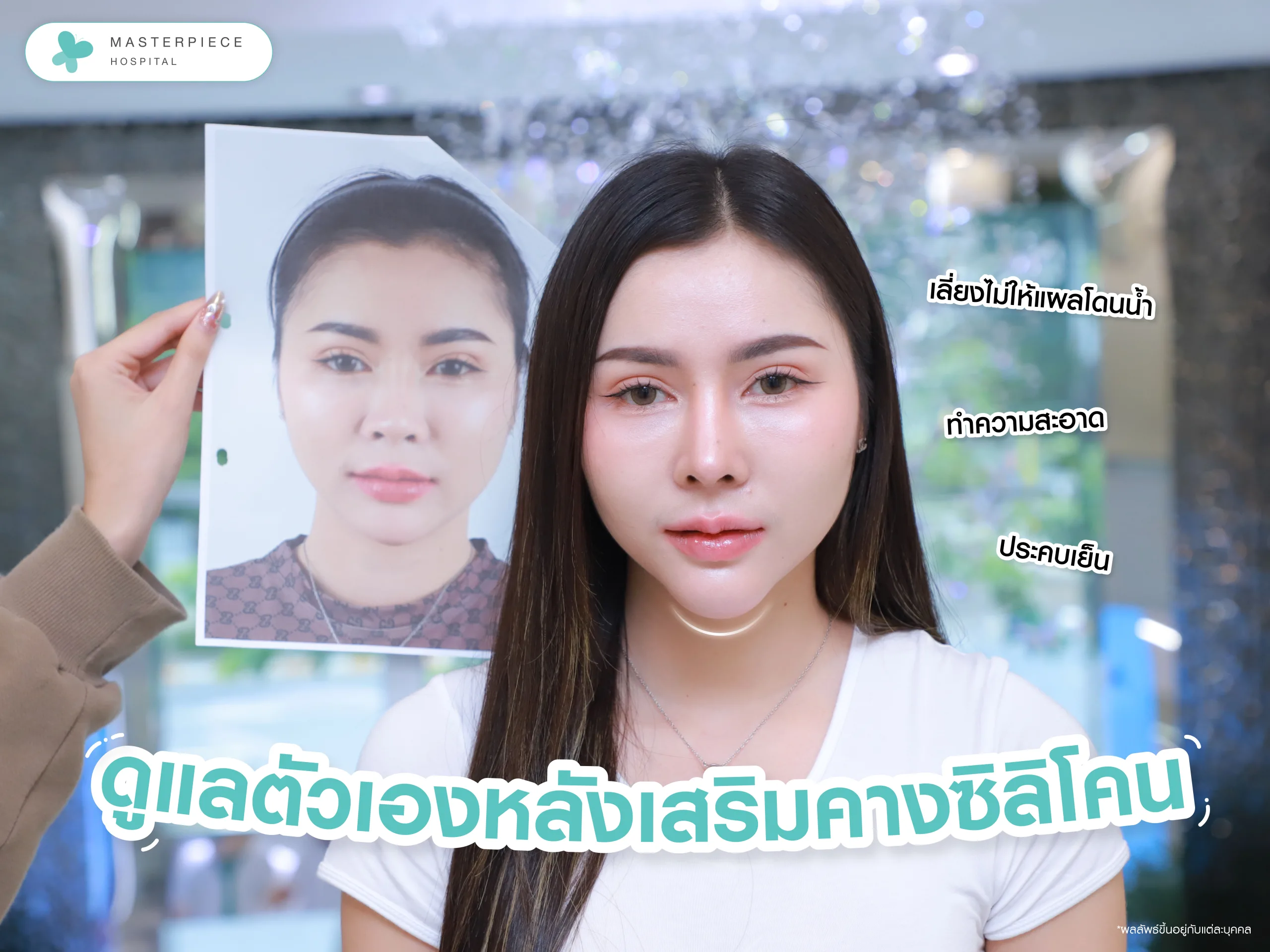 ขั้นตอนดูแลตัวเองหลังผ่าตัดเสริมคางซิลิโคน