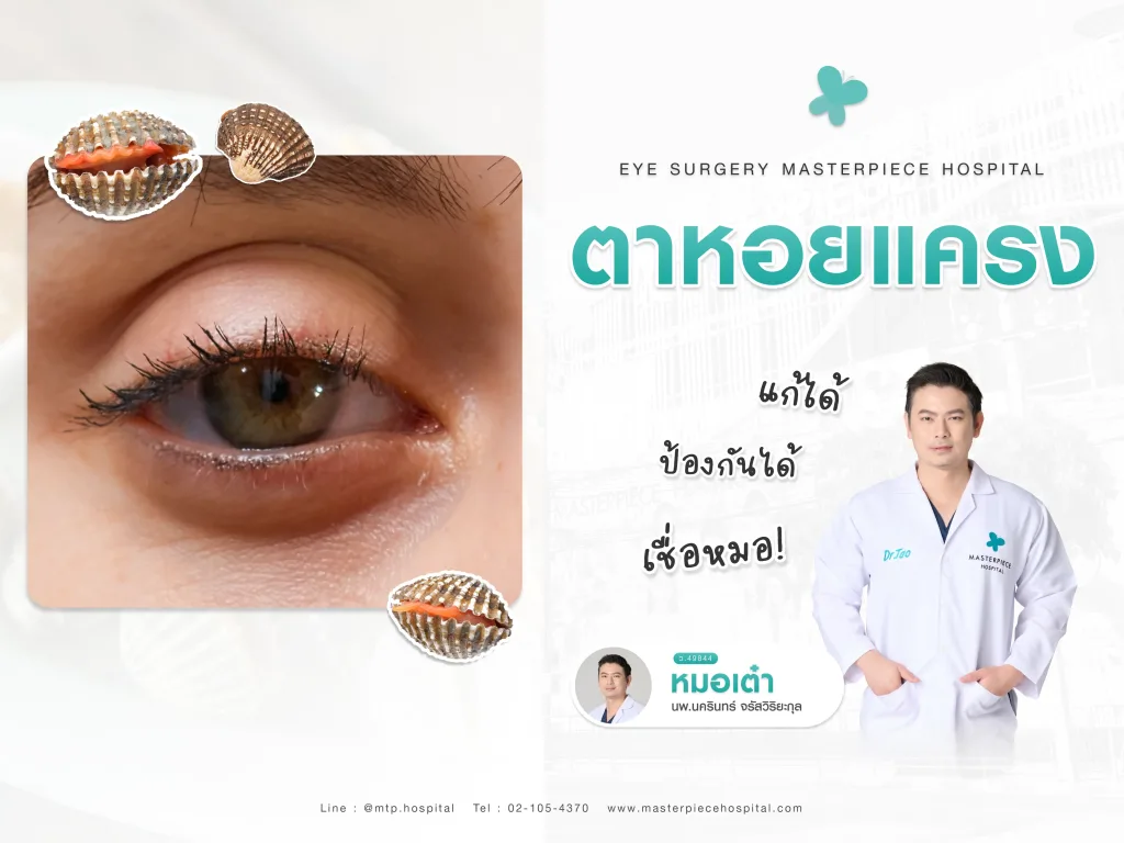 ตาหอยแครงคืออะไร แก้ได้ ป้องกันได้