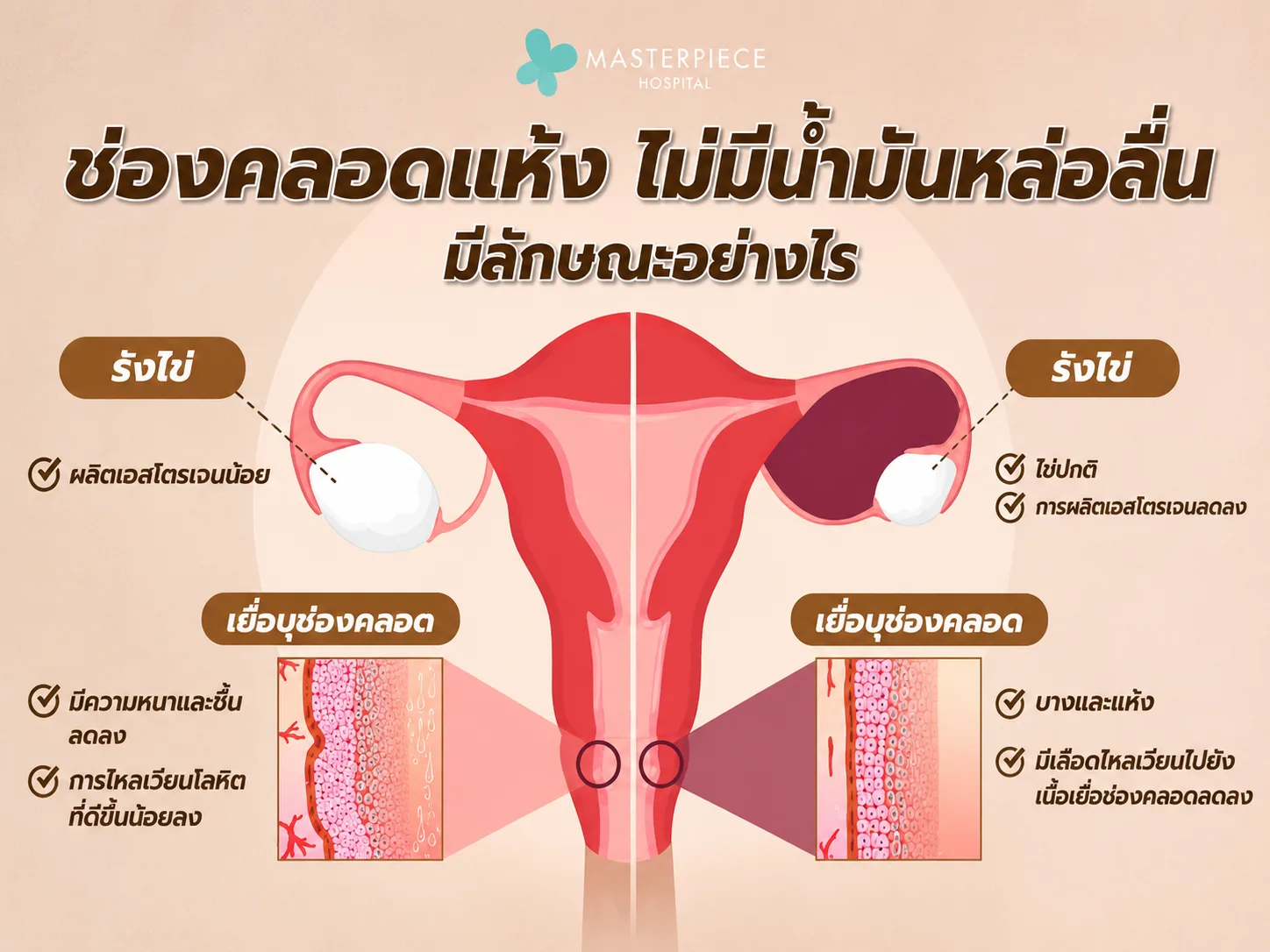 ช่องคลอดแห้ง ไม่มีน้ำมันหล่อลื่น มีลักษณะอย่างไร