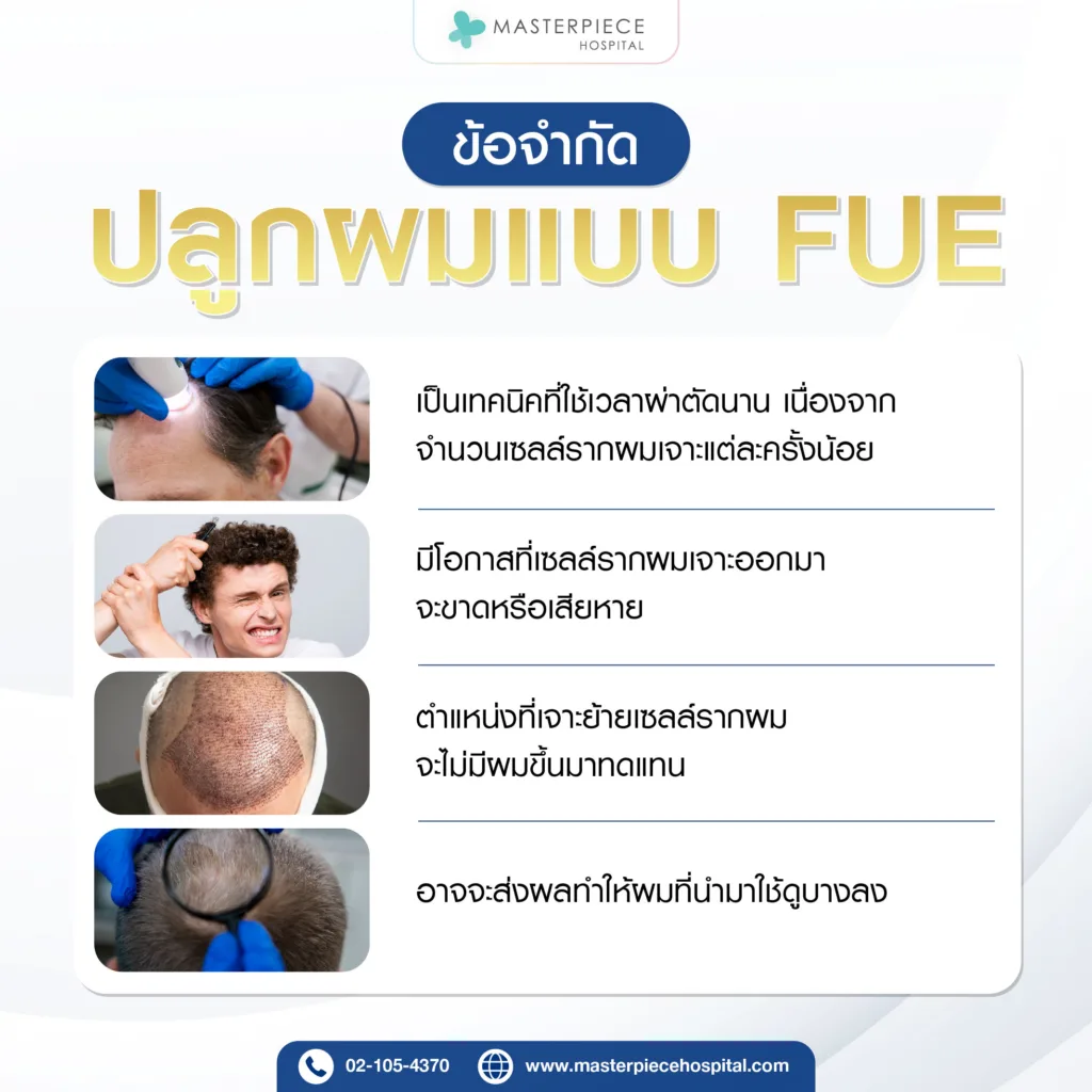 ข้อจำกัดของการปลูกผมแบบ FUE ข้อจำกัดของการปลูกผมแบบ FUE