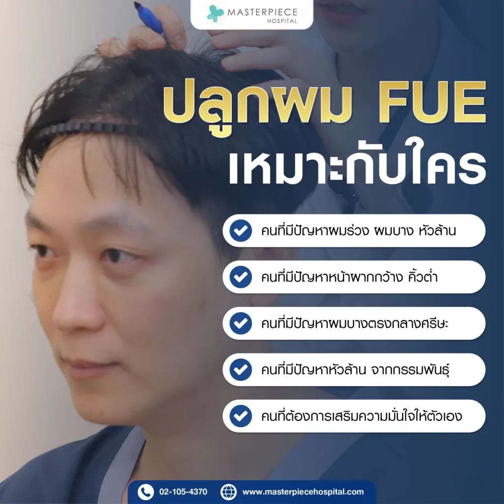 ปลูกผม FUE เหมาะสำหรับใคร?