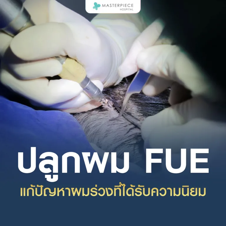 ปลูกผม FUE วิธีแก้ปัญหาผมบางและศีรษะล้านที่เห็นผลจริง