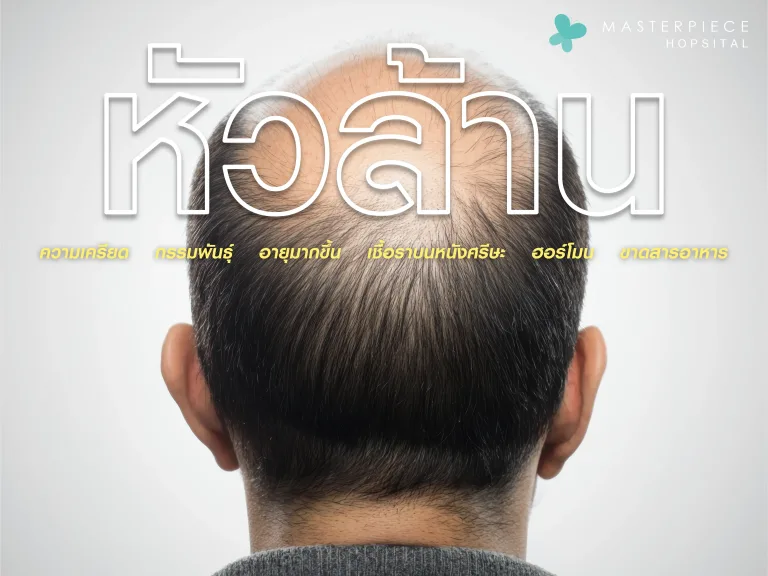 หัวล้าน จากความเครียด สาเหตุและวิธีรักษา