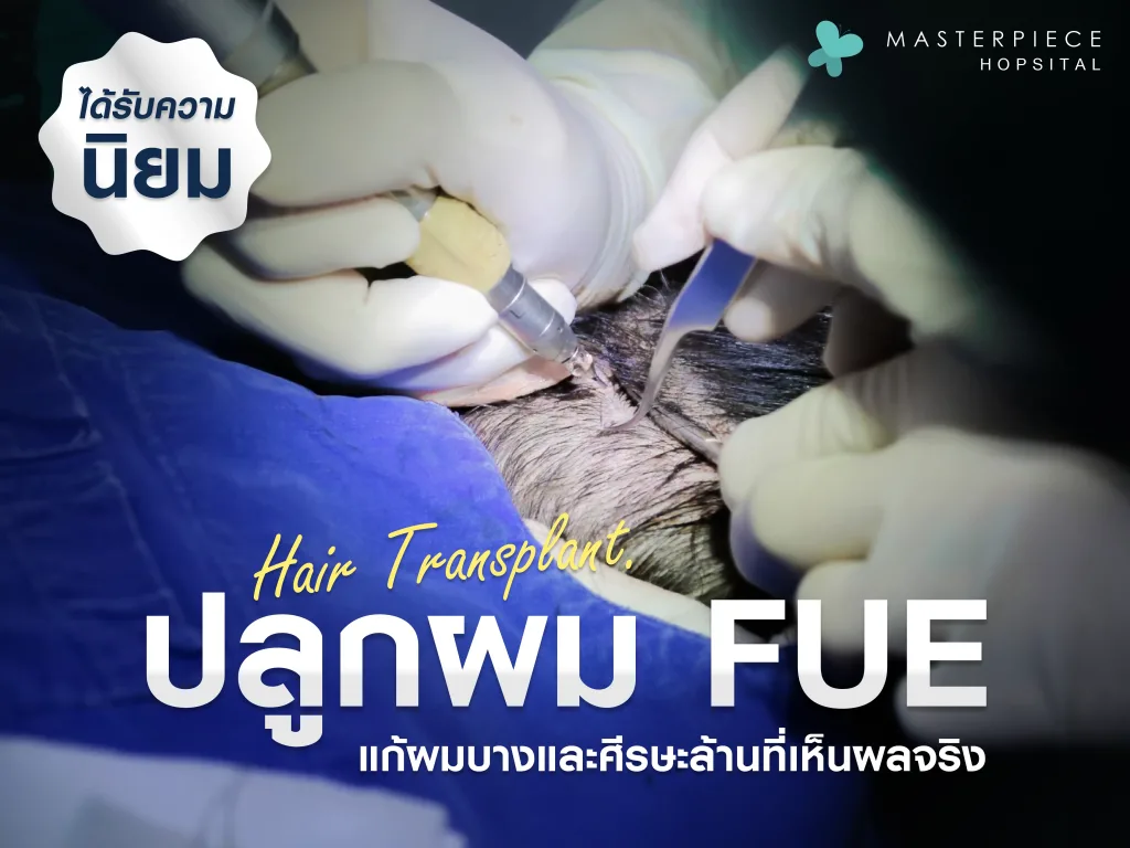 ปลูกผม FUE วิธีแก้ปัญหาผมบาง