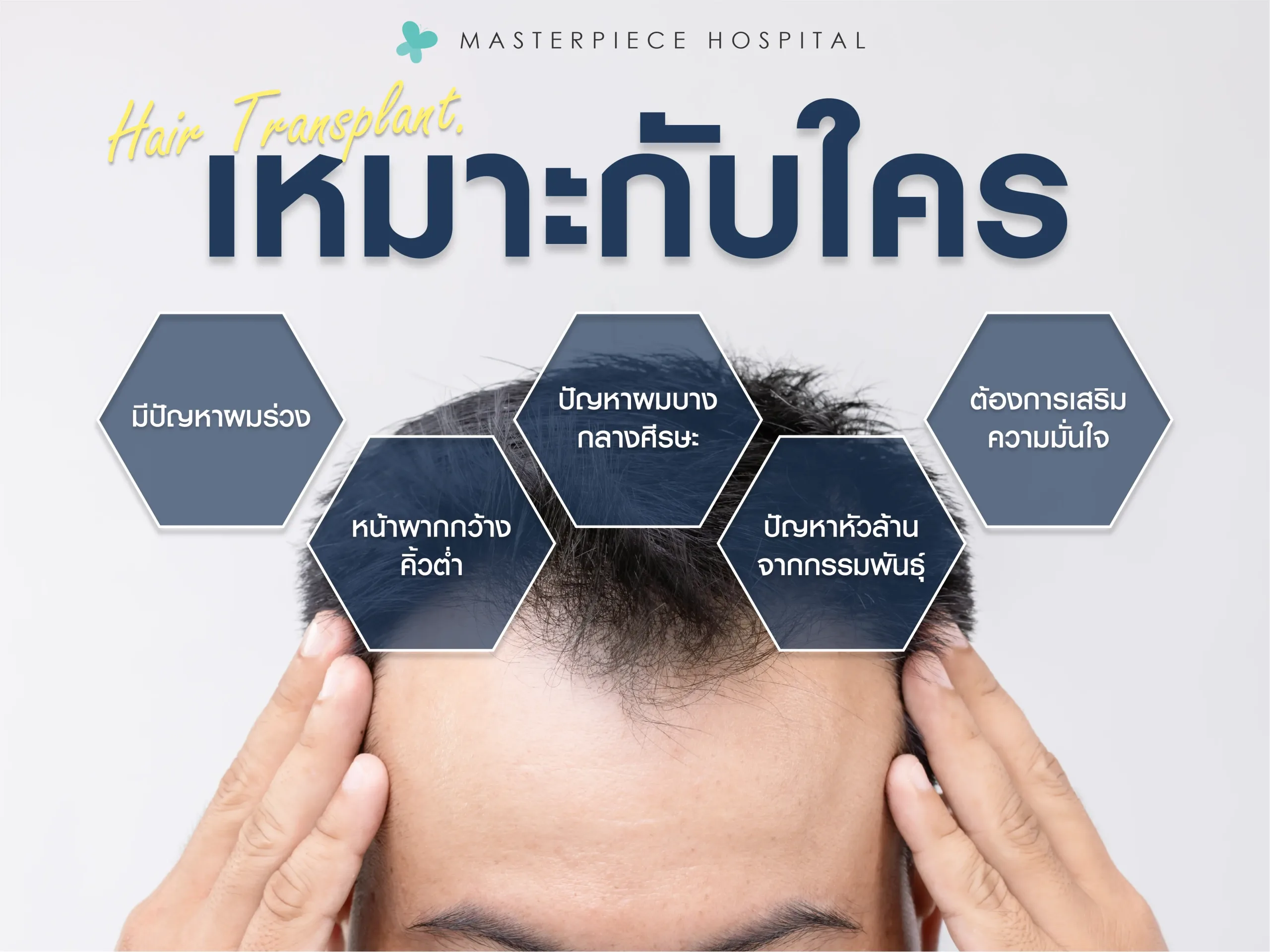 ปลูกผม FUE เหมาะสำหรับใคร?