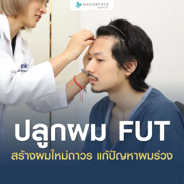 ปลูกผม FUT สร้างผมใหม่ถาวร แก้ปัญหาผมร่วงอย่างตรงจุด