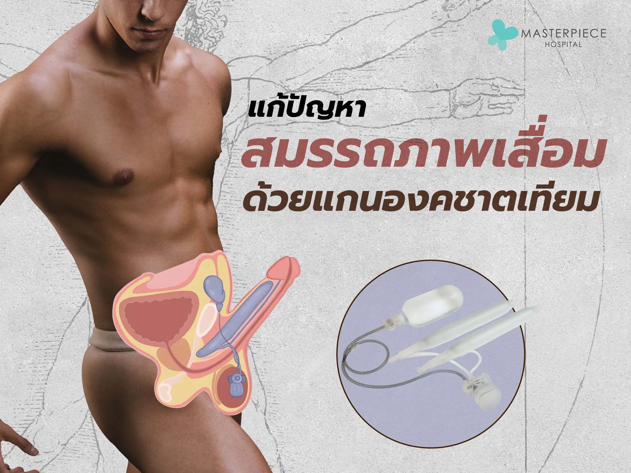 แกนองคชาติเทียม