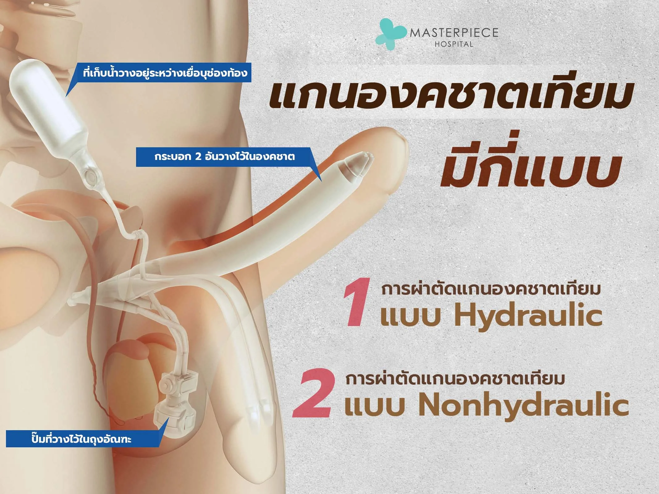 องคชาติเทียมมีกี่แบบ