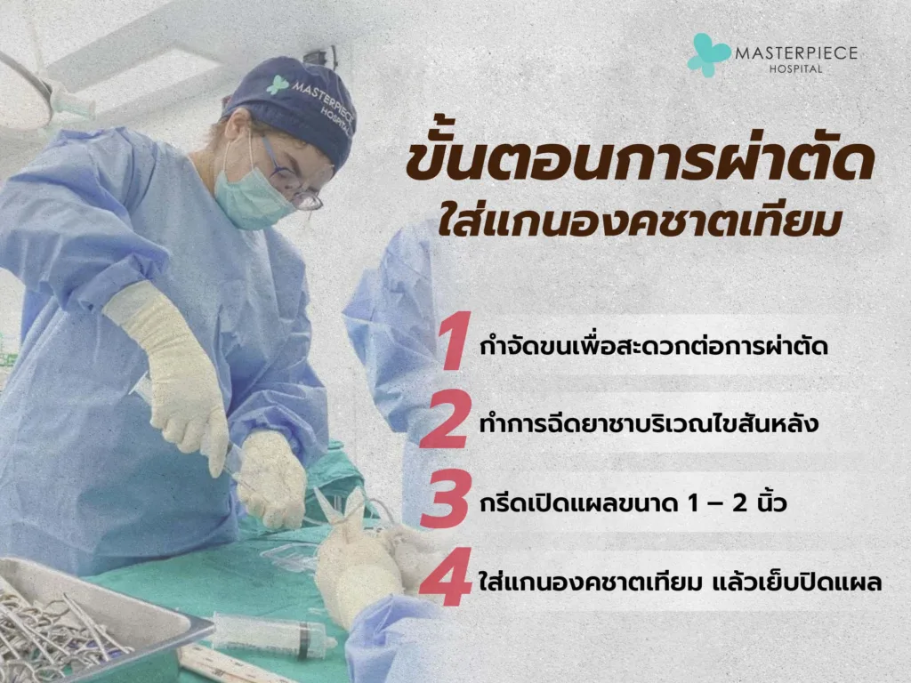 ขั้นตอนการใส่องคชาติเทียม
