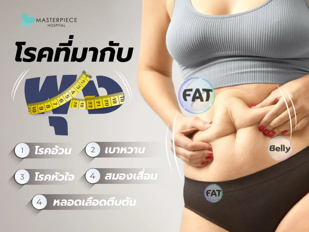 โรคที่มากับ "พุง" โรคที่มากับ "พุง"
