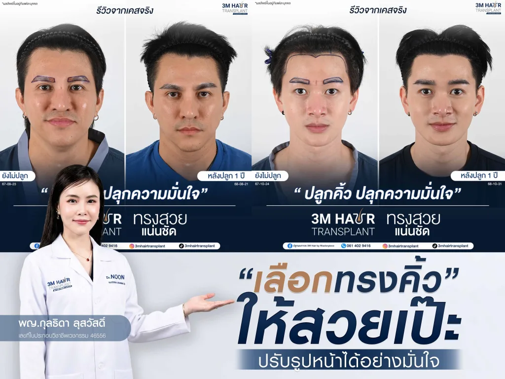 เลือกทรงคิ้วให้สวยเป๊ะ ปรับรูปหน้าได้อย่างมั่นใจ