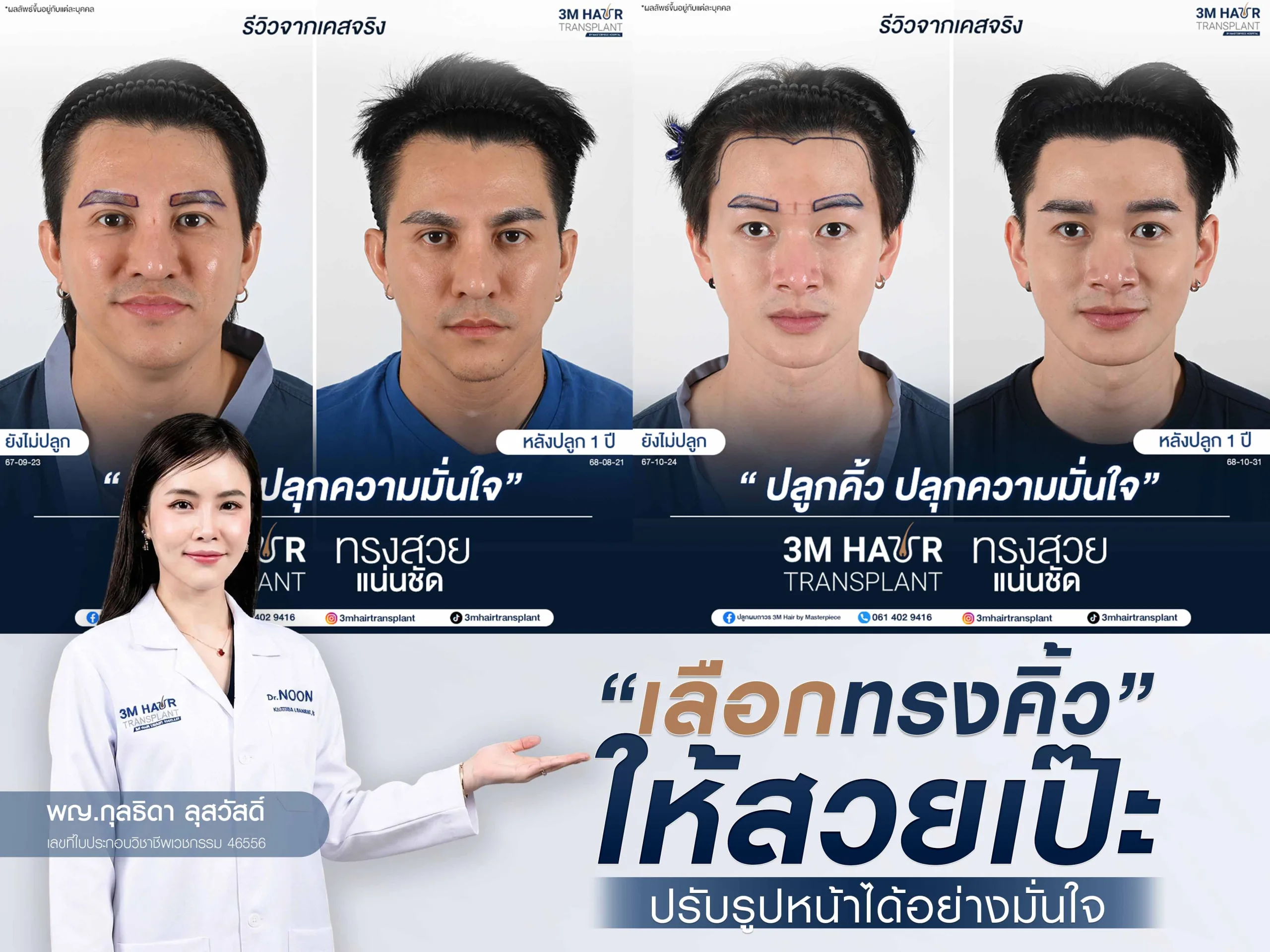 เลือกทรงคิ้วให้สวยเป๊ะ ปรับรูปหน้าได้อย่างมั่นใจ