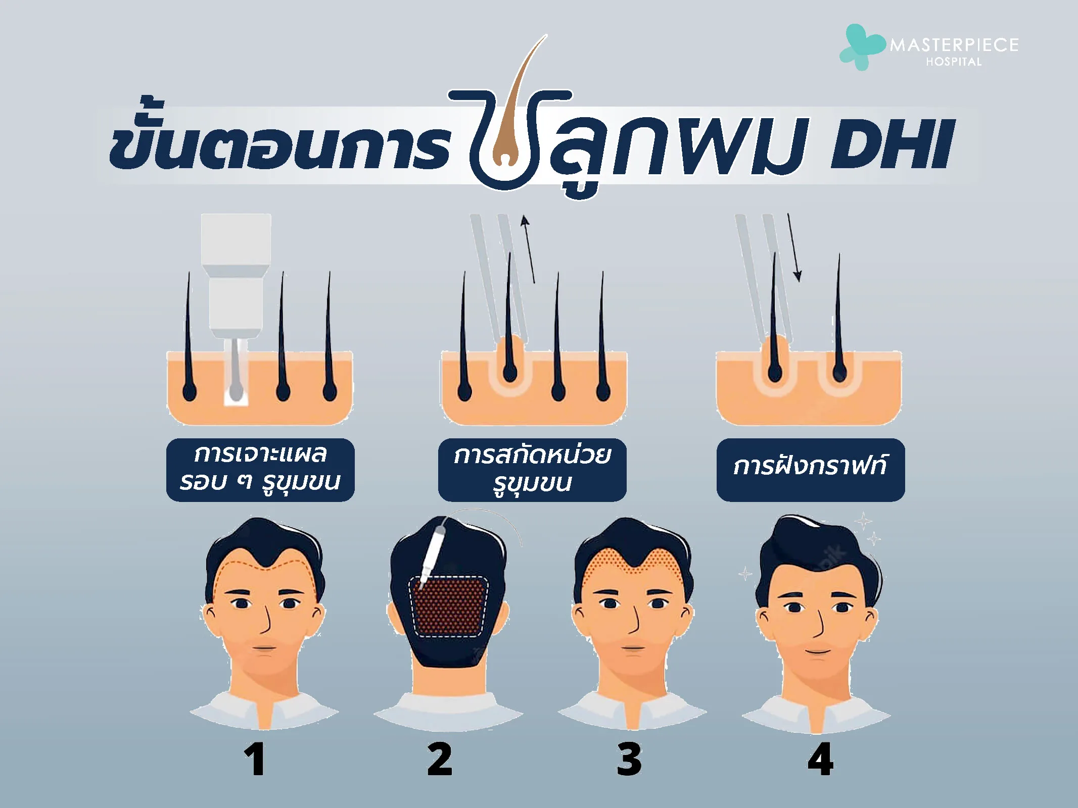 เปรียบเทียบ DHI กับเทคนิคปลูกผมอื่นๆ เปรียบเทียบ DHI กับเทคนิคปลูกผมอื่นๆ
