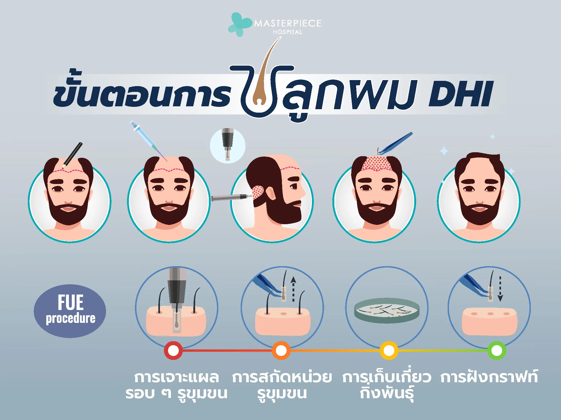 ขั้นตอนการปลูกผม DHI ขั้นตอนการปลูกผม DHI