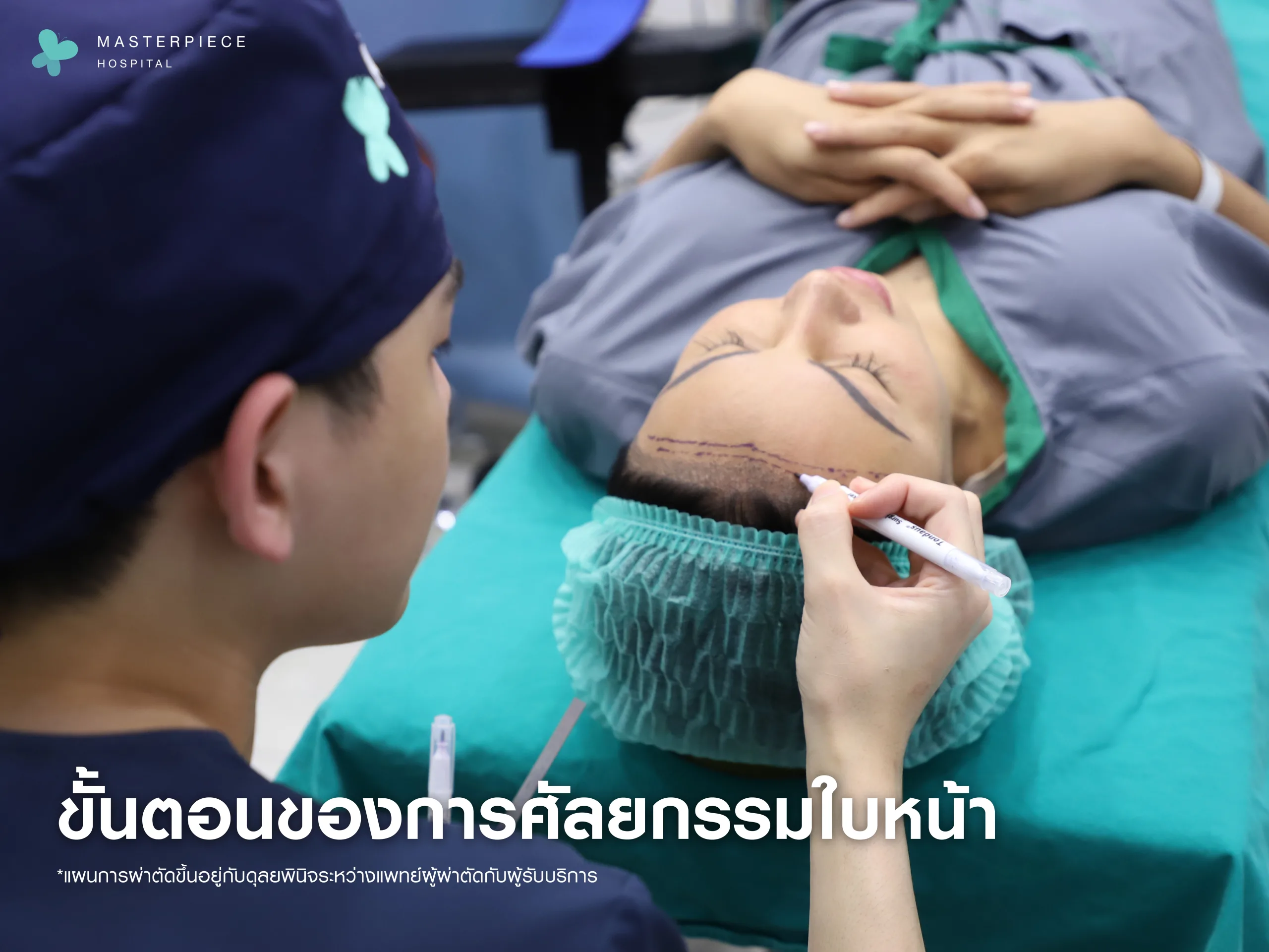 ขั้นตอนของการศัลยกรรมใบหน้าเพื่อความเป็นหญิง