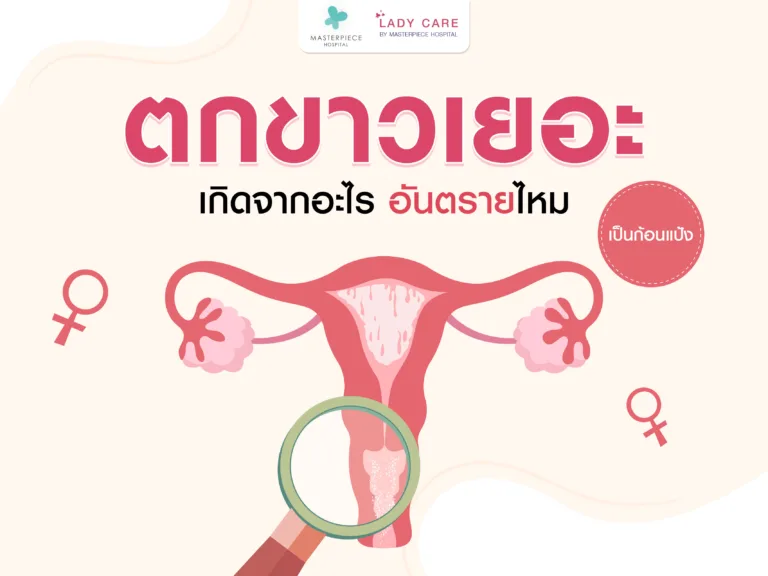 ตกขาวเยอะเป็นก้อนแป้ง เกิดจากอะไร อันตรายไหม ?