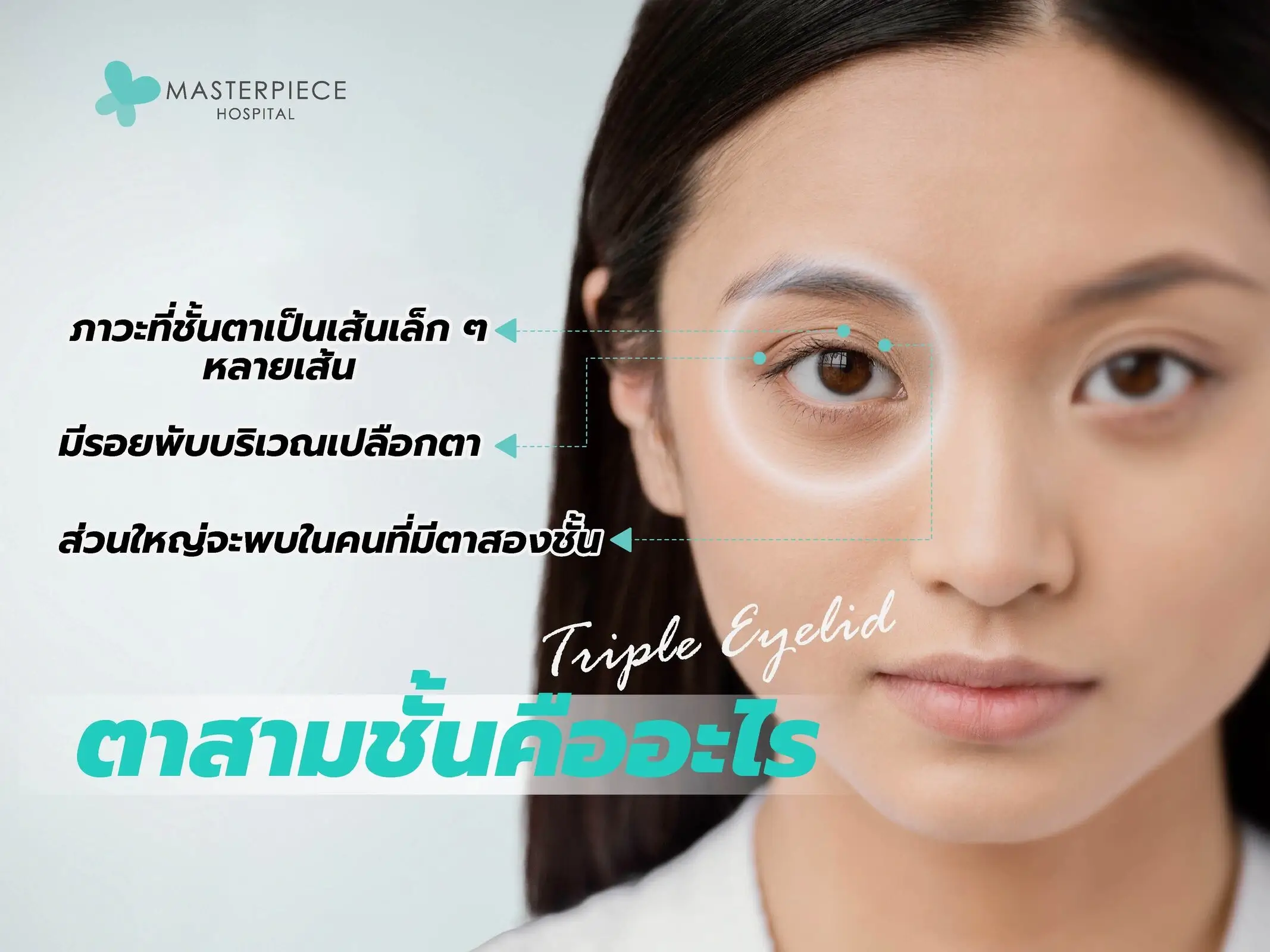 ตาสามชั้นคืออะไร