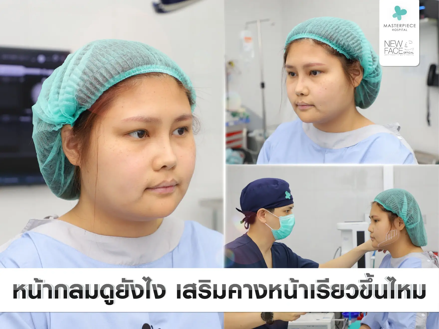 หน้ากลมดูยังไง เสริมคางหน้าเรียวขึ้นไหม