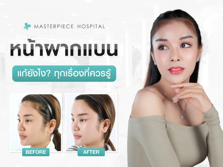 หน้าผากแบน แก้ยังไง? ทุกเรื่องที่คุณควรรู้