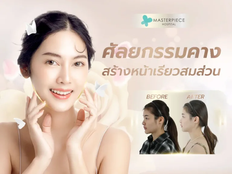 ศัลยกรรมคาง  สร้างหน้าเรียวยาว สมส่วน