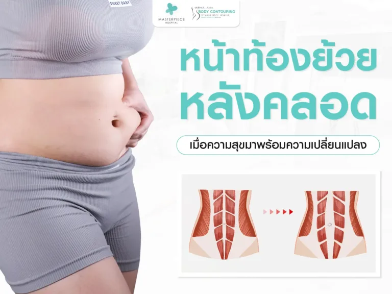 หน้าท้องย้วยหลังคลอด เมื่อความสุขมาพร้อมความเปลี่ยนแปลง