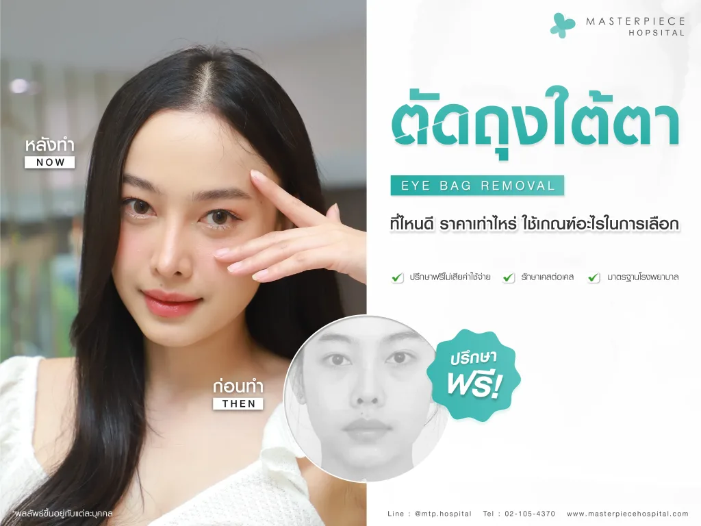 ตัดถุงใต้ตาที่ไหนดี ราคาเท่าไหร่ ใช้เกณฑ์อะไรในการเลือก
