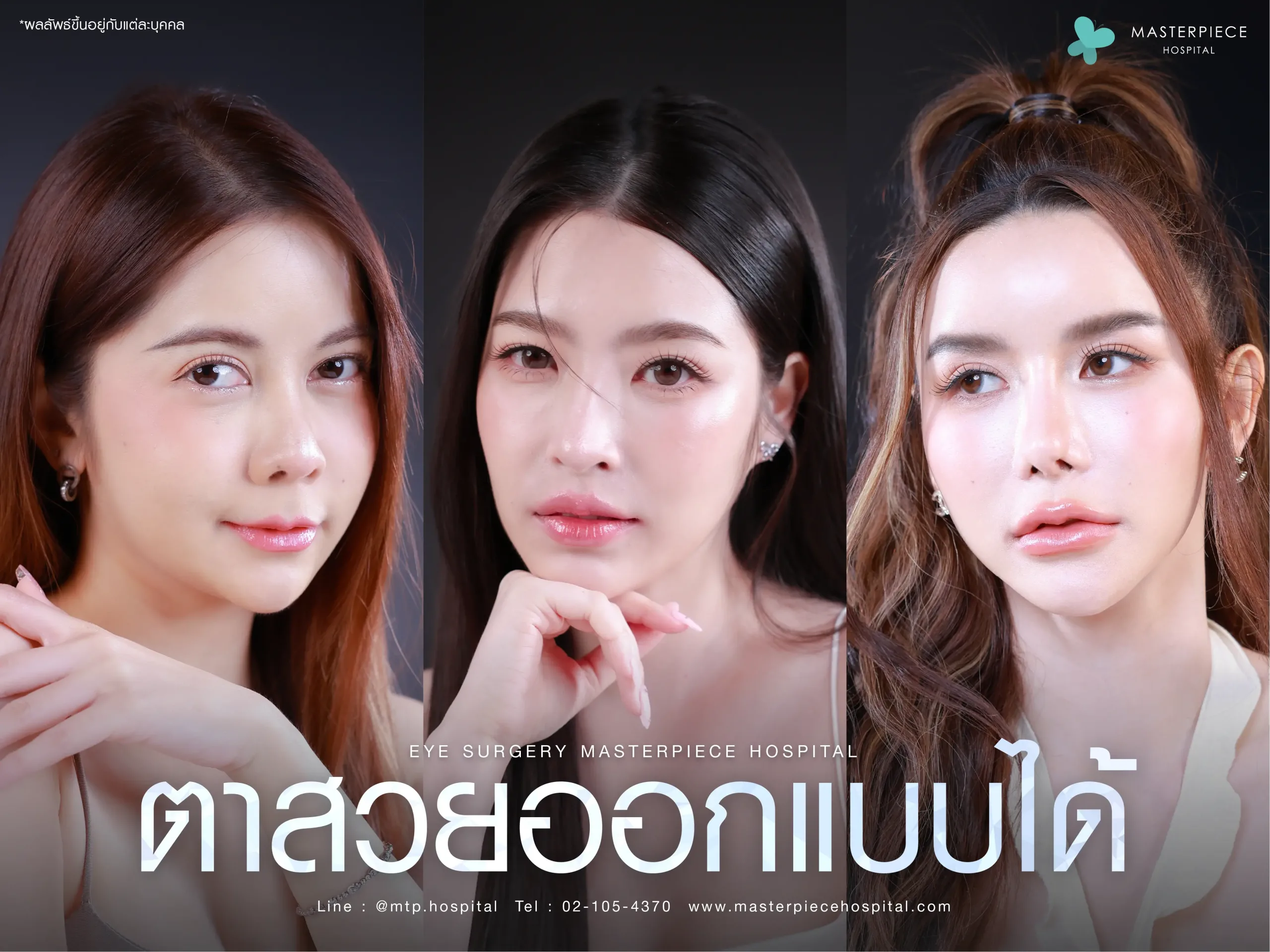 อยากมีตาสวยที่ออกแบบได้ ปรึกษาฟรีที่มาสเตอร์พีช